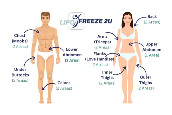 Areas you can have fat freezing treatment Rugby