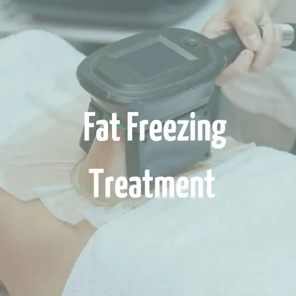 fat freezing treatment Rugby
