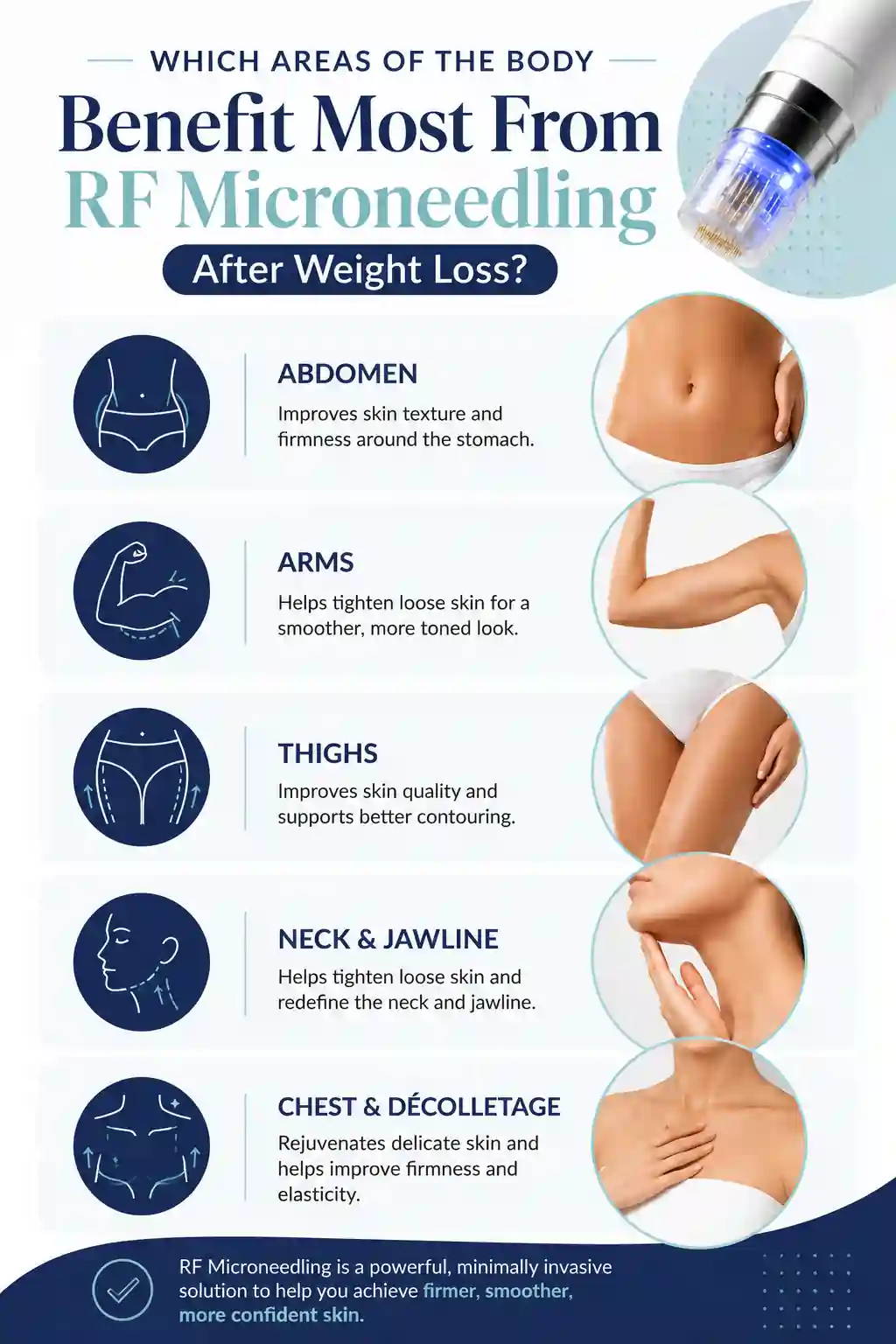 Which Areas of the Body Benefit Most From RF Microneedling After Weight Loss Rugby